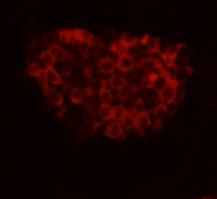 Fig2: ICC image of FAT4 antibody stained D3 (Murine Embryonic Stem Cell Line).The secondary antibody (red) was goat anti-rabbit IgG (H+L) alexa555 conjugated.