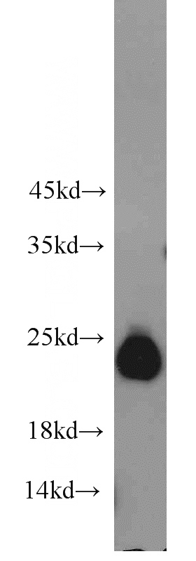 human brain tissue were subjected to SDS PAGE followed by western blot with Catalog No:110958(GGCT antibody) at dilution of 1:800