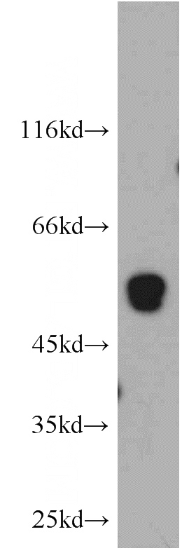 human testis tissue were subjected to SDS PAGE followed by western blot with Catalog No:116084(TMCO6 antibody) at dilution of 1:500