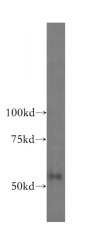 human kidney tissue were subjected to SDS PAGE followed by western blot with Catalog No:110058(domain-I-of-FIZ-1 antibody) at dilution of 1:200