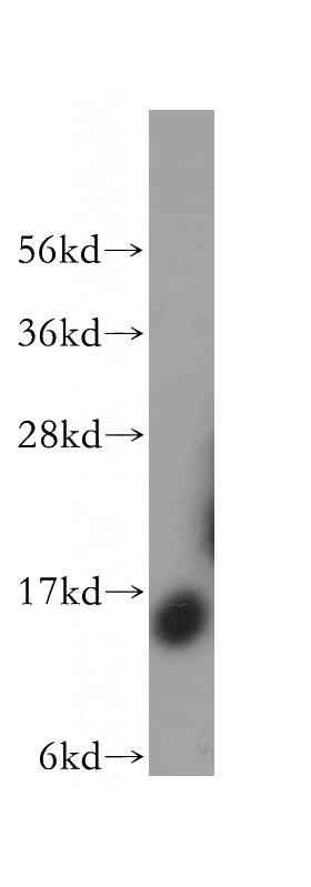 human liver tissue were subjected to SDS PAGE followed by western blot with Catalog No:115033(SDHC antibody) at dilution of 1:400