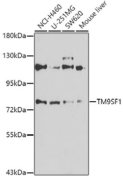 Western blot - TM9SF1 Polyclonal Antibody 