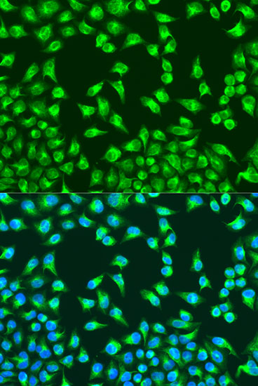 Immunofluorescence - MTCO2 Polyclonal Antibody 