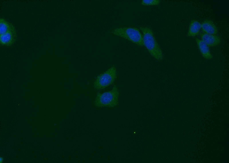 Immunofluorescent analysis of MCF-7 cells using Catalog No:115722(STK38 Antibody) at dilution of 1:50 and Alexa Fluor 488-congugated AffiniPure Goat Anti-Rabbit IgG(H+L)