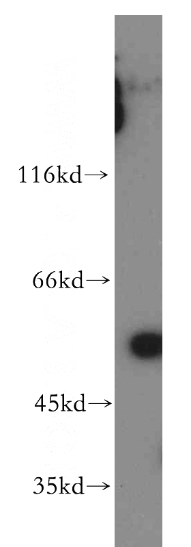 human skeletal muscle tissue were subjected to SDS PAGE followed by western blot with Catalog No:113499(PAK2 antibody) at dilution of 1:300