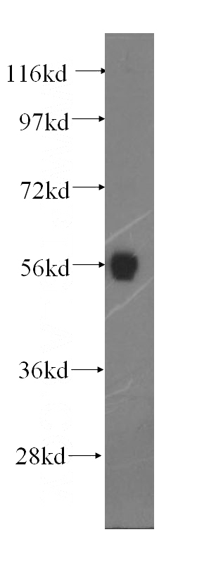 mouse testis tissue were subjected to SDS PAGE followed by western blot with Catalog No:114321(PTPN4 antibody) at dilution of 1:300