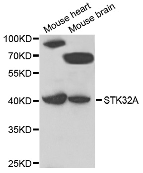 Western blot - STK32A Polyclonal Antibody 