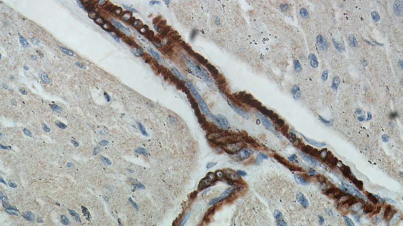 Immunohistochemical of paraffin-embedded human heart using Catalog No:115397(ACTA2-Specific antibody) at dilution of 1:100 (under 40x lens)