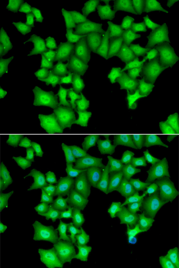 Immunofluorescence - CPSF3L Polyclonal Antibody 