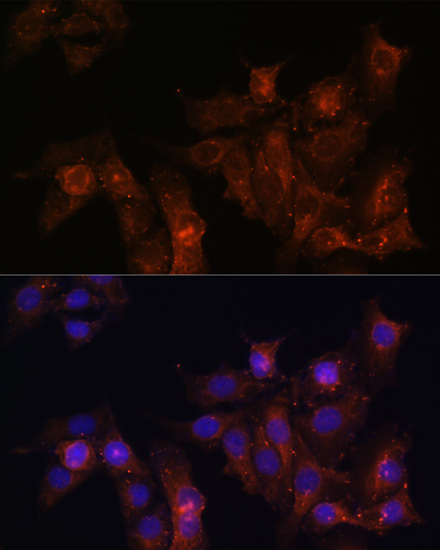 Immunofluorescence - DMD Polyclonal Antibody 
