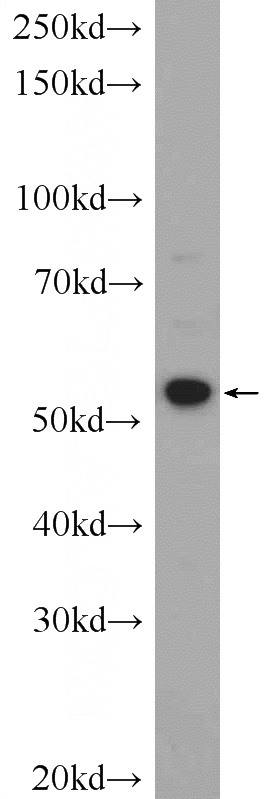 PC-3 cells were subjected to SDS PAGE followed by western blot with Catalog No:117154(ZNF277 Antibody) at dilution of 1:300