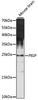 Western blot - PIGP Polyclonal Antibody 