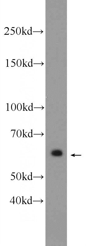 mouse brain tissue were subjected to SDS PAGE followed by western blot with Catalog No:110220(EGR1 Antibody) at dilution of 1:300