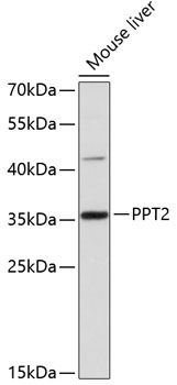 Western blot - PPT2 Polyclonal Antibody 