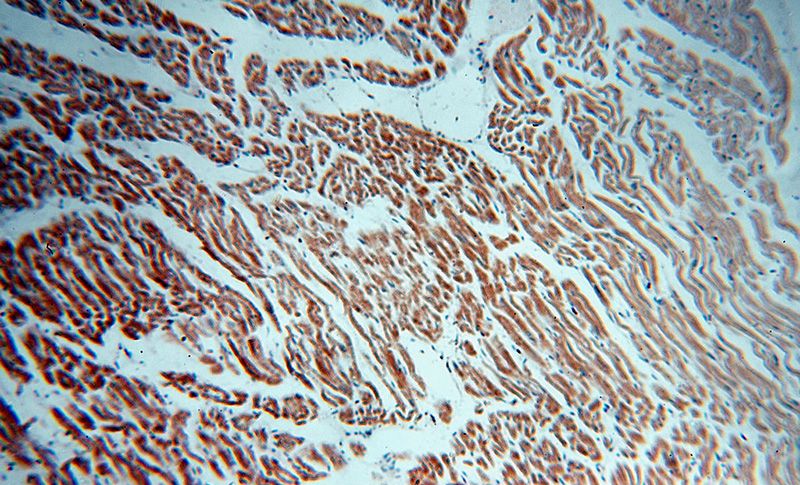 Immunohistochemical of paraffin-embedded human heart using Catalog No:111674(IFT88 antibody) at dilution of 1:50 (under 10x lens)