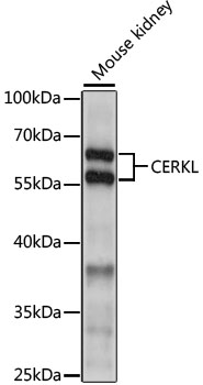 Western blot - CERKL Polyclonal Antibody 
