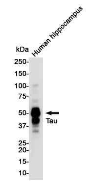 Western blot detection of Tau (Phospho-Thr50) in Human Hippocampus lysates using Tau (Phospho-Thr50) Rabbit pAb(1:1000 diluted).Predicted band size:79KDa.Observed band size:50-80KDa.