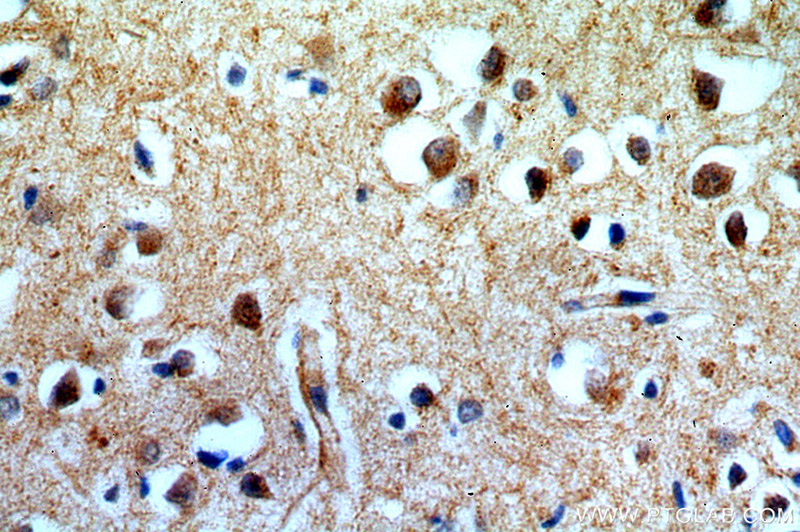 Immunohistochemical of paraffin-embedded human brain using Catalog No:109738(CUEDC2 antibody) at dilution of 1:100 (under 40x lens)