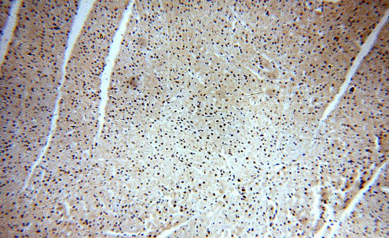 Immunohistochemical of paraffin-embedded human heart using Catalog No:111004(GNL1 antibody) at dilution of 1:100 (under 10x lens)