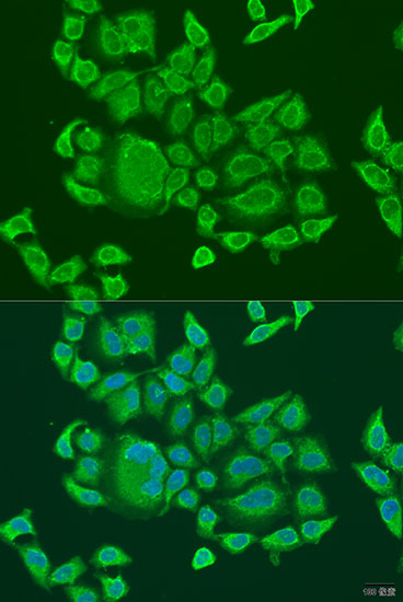 Immunofluorescence - DHX58 Polyclonal Antibody 