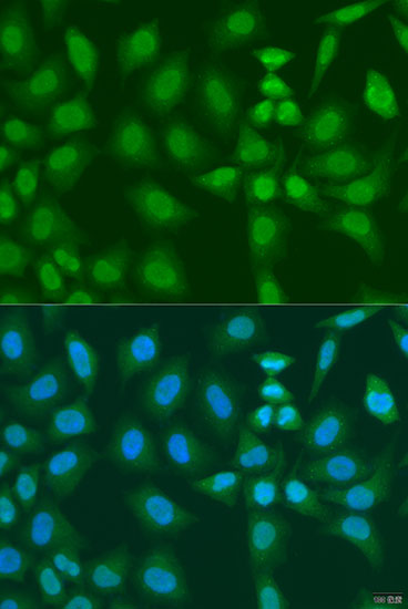 Immunofluorescence - PHF21B Polyclonal Antibody 