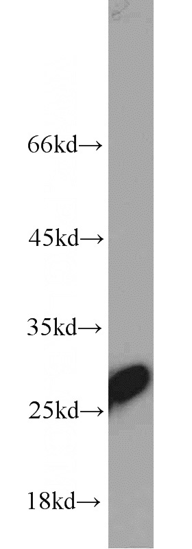 HepG2 cells were subjected to SDS PAGE followed by western blot with Catalog No:116265(TPI1 antibody) at dilution of 1:2000