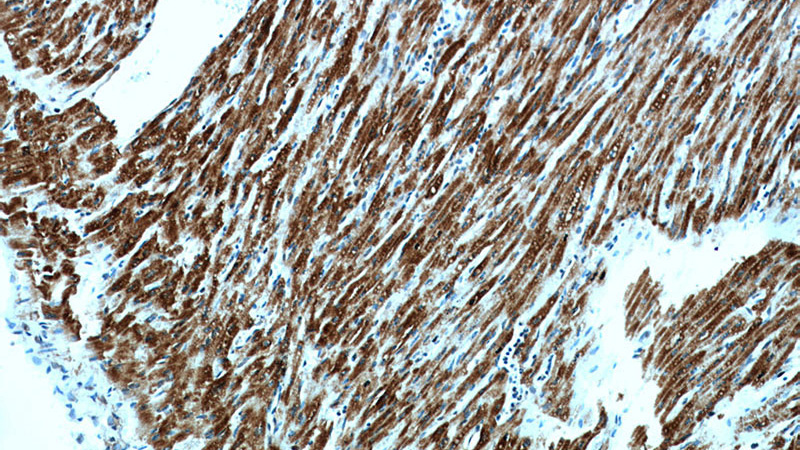 Immunohistochemical of paraffin-embedded human heart using Catalog No:108205(ART5 antibody) at dilution of 1:50 (under 10x lens)