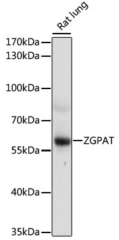 Western blot - ZGPAT Polyclonal Antibody 