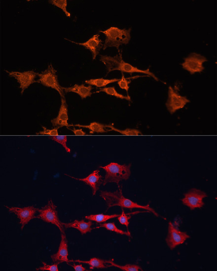 Immunofluorescence - GSTM3 Polyclonal Antibody 