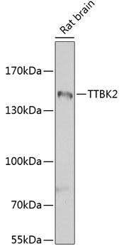 Western blot - TTBK2 Polyclonal Antibody 