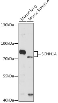 Western blot - SCNN1A Polyclonal Antibody 