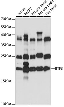Western blot - BTF3 Polyclonal Antibody 