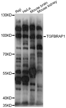 Western blot - TGFBRAP1 Polyclonal Antibody 