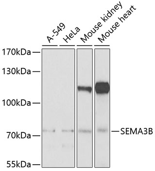 Western blot - SEMA3B Polyclonal Antibody 