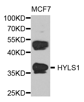 Western blot - HYLS1 Polyclonal Antibody 