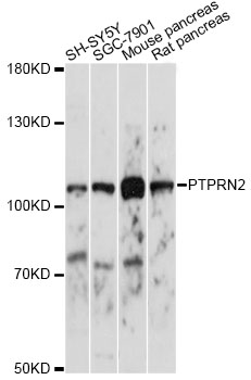 Western blot - PTPRN2 Polyclonal Antibody 