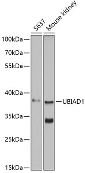 Western blot - UBIAD1 Polyclonal Antibody 