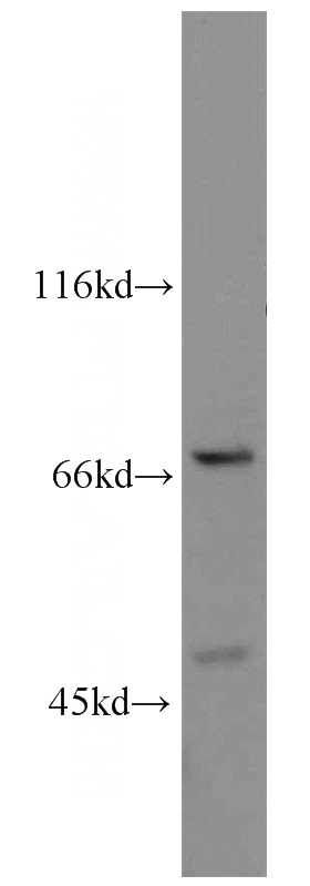 HeLa cells were subjected to SDS PAGE followed by western blot with Catalog No:114065(POT1 antibody) at dilution of 1:500