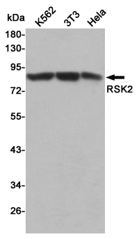 Western blot detection of RSK2 in K562,3T3 and Hela cell lysates using RSK2 mouse mAb (1:500 diluted).Predicted band size:80KDa.Observed band size:90KDa.