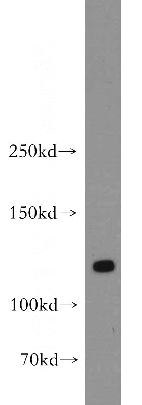 human brain tissue were subjected to SDS PAGE followed by western blot with Catalog No:109993(DLGAP3 antibody) at dilution of 1:500