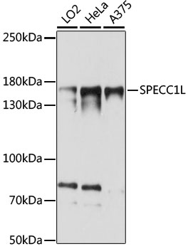 Western blot - SPECC1L Polyclonal Antibody 