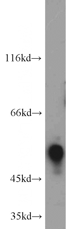 K-562 cells were subjected to SDS PAGE followed by western blot with Catalog No:110487(ETS2 antibody) at dilution of 1:1000