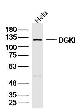 Fig1: Sample:Hela (Human)Cell Lysate at 40 ug; Primary: Anti-DGKI at 1/300 dilution; Secondary: IRDye800CW Goat Anti-RabbitIgG at 1/20000 dilution; Predicted band size: 117kD; Observed band size: 117kD