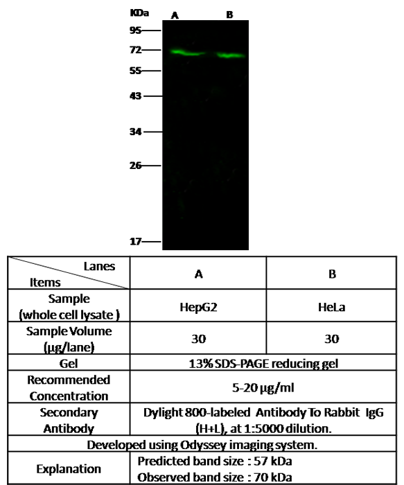 Human CYP2E1/Cytochrome P450 2E1 Western blot (WB) 14638