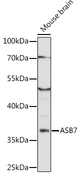 Western blot - ASB7 Polyclonal Antibody 