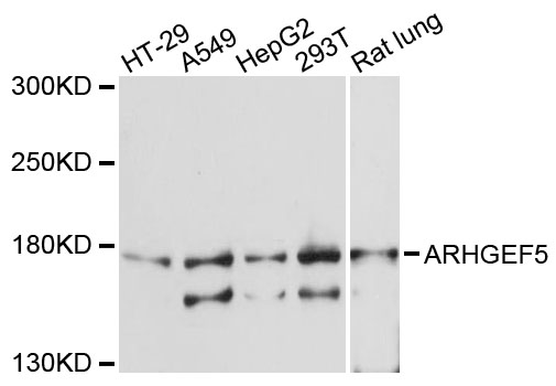 Western blot - ARHGEF5 Polyclonal Antibody 
