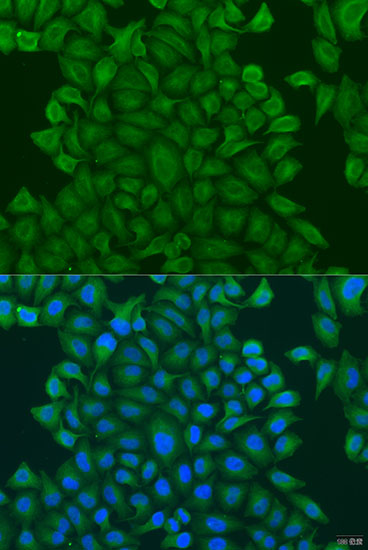 Immunofluorescence - GSTM3 Polyclonal Antibody 