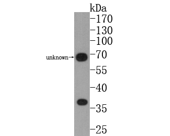Fig2:; Western blot analysis of CD24 on mouse thymus tissue lysates. Proteins were transferred to a PVDF membrane and blocked with 5% BSA in PBS for 1 hour at room temperature. The primary antibody ( 1/1000) was used in 5% BSA at room temperature for 2 hours. Goat Anti-Rabbit IgG - HRP Secondary Antibody (HA1001) at 1:200,000 dilution was used for 1 hour at room temperature.