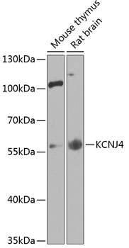 Western blot - KCNJ4 Polyclonal Antibody 