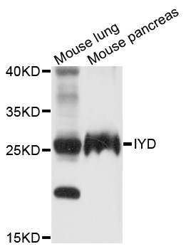 Western blot - IYD Polyclonal Antibody 